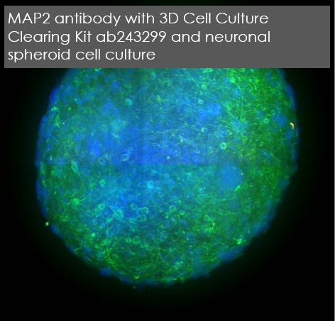 Immunocytochemistry/ Immunofluorescence - Anti-MAP2 antibody [EPR19691] (ab183830), expandable thumbnail