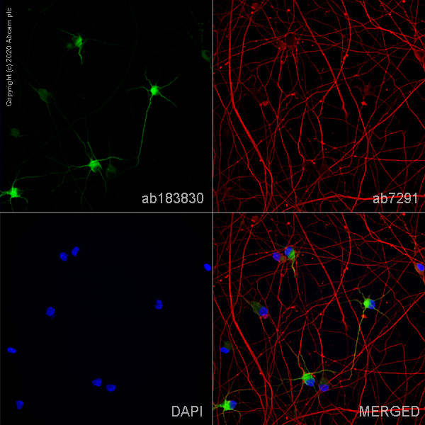 Immunocytochemistry/ Immunofluorescence - Anti-MAP2 antibody [EPR19691] - Neuronal Marker (ab183830), expandable thumbnail