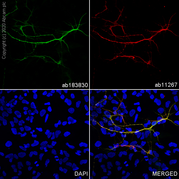 Immunocytochemistry/ Immunofluorescence - Anti-MAP2 antibody [EPR19691] (AB183830), expandable thumbnail