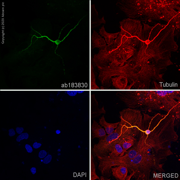 Immunocytochemistry/ Immunofluorescence - Anti-MAP2 antibody [EPR19691] (AB183830), expandable thumbnail