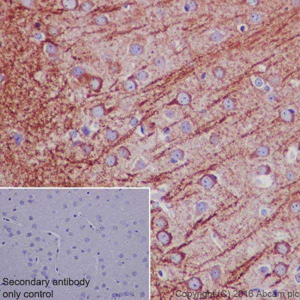 Immunohistochemistry (Formalin/PFA-fixed paraffin-embedded sections) - Anti-MAP2 antibody [EPR19691] (AB183830), expandable thumbnail