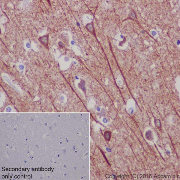 Immunohistochemistry (Formalin/PFA-fixed paraffin-embedded sections) - Anti-MAP2 antibody [EPR19691] (ab183830), expandable thumbnail