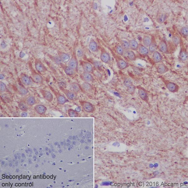 Immunohistochemistry (Formalin/PFA-fixed paraffin-embedded sections) - Anti-MAP2 antibody [EPR19691] - Neuronal Marker (ab183830), expandable thumbnail