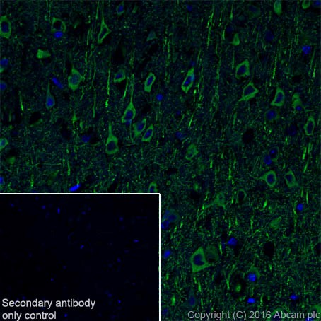 Immunohistochemistry (Frozen sections) - Anti-MAP2 antibody [EPR19691] - Neuronal Marker (AB183830), expandable thumbnail