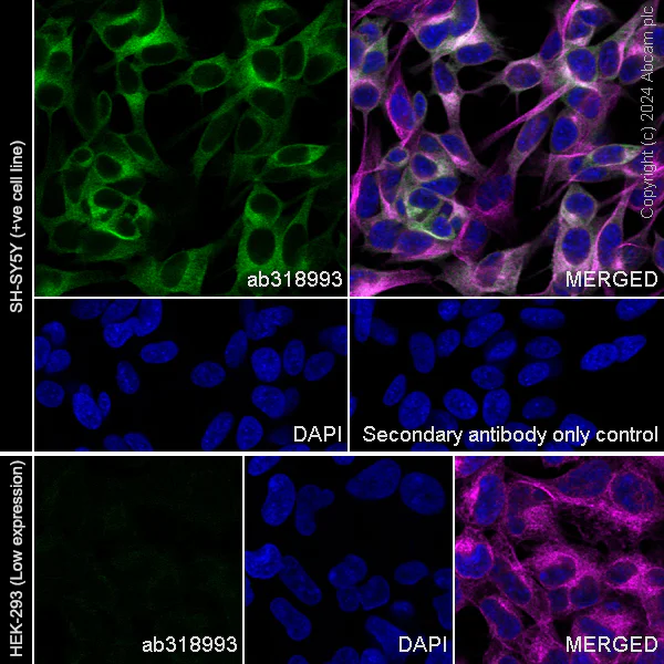 Immunocytochemistry/ Immunofluorescence - Anti-MAP2 antibody [EPR19691] - Neuronal Marker - Chicken IgY (Chimeric) (AB318993)