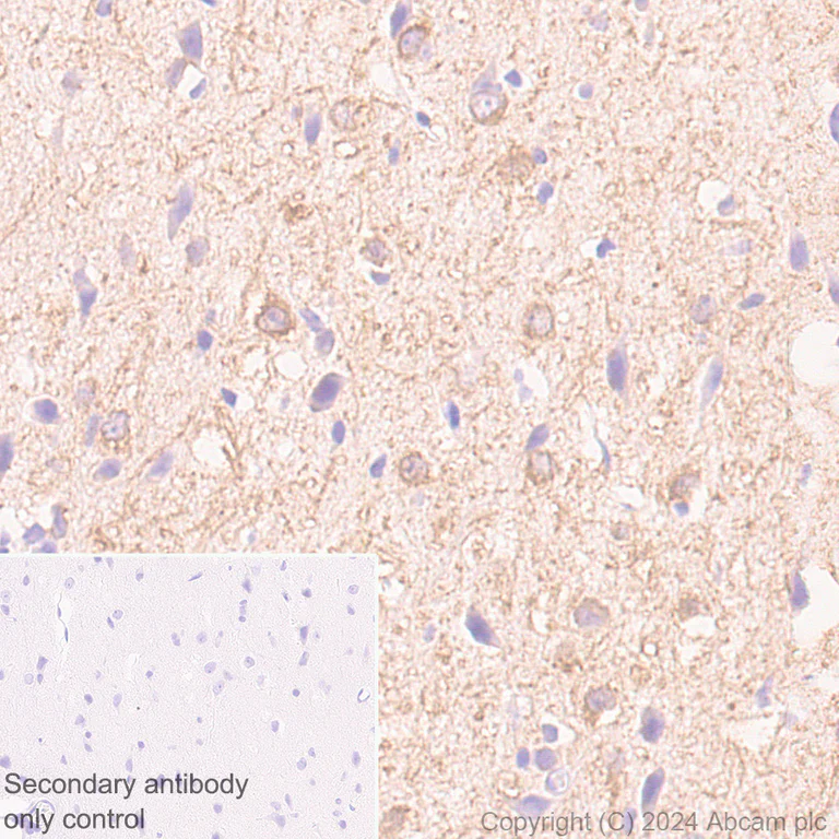 Immunohistochemistry (Formalin/PFA-fixed paraffin-embedded sections) - Anti-MAP2 antibody [EPR19691] - Neuronal Marker - Chicken IgY (Chimeric) (AB318993)