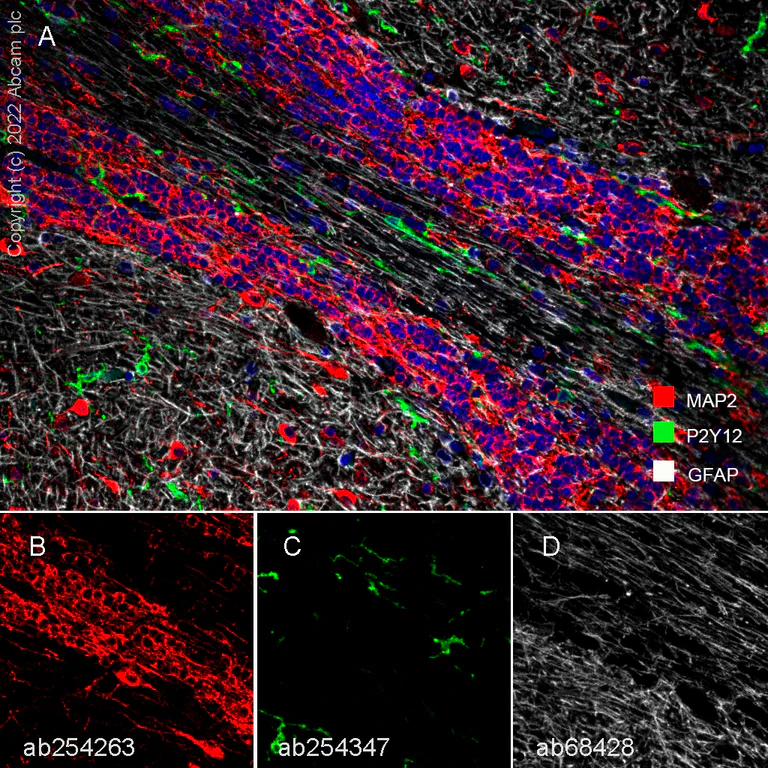 Anti-MAP2 antibody [EPR22641-106] - BSA and Azide free (ab256511) | Abcam