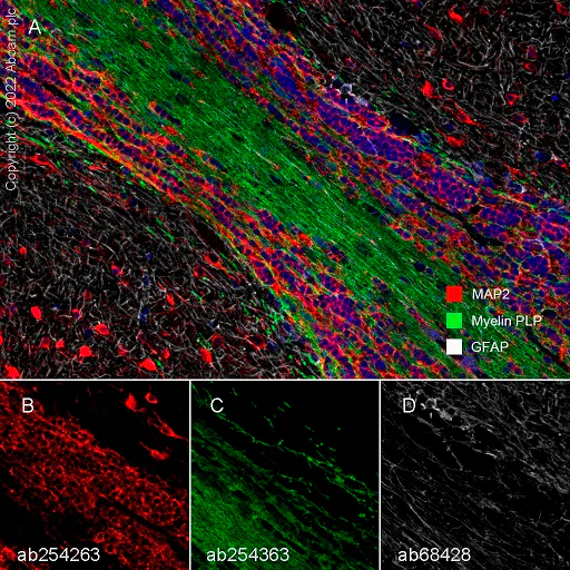 Multiplex immunohistochemistry - Anti-MAP2 antibody [EPR22641-106] - BSA and Azide free (AB256511)