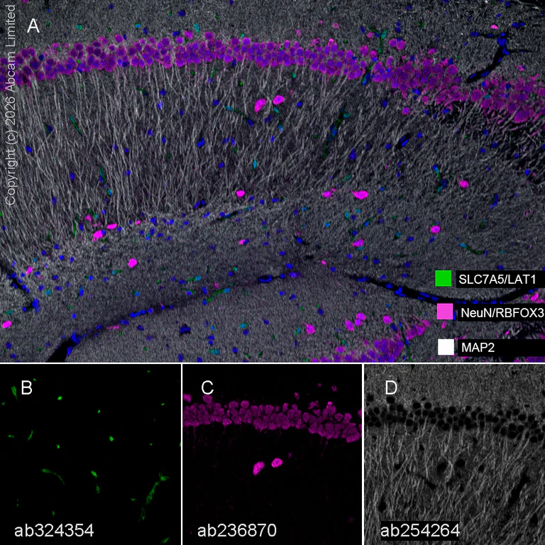 Multiplex immunohistochemistry - Anti-MAP2 antibody [EPR22641-16] - BSA and Azide free (AB256512)