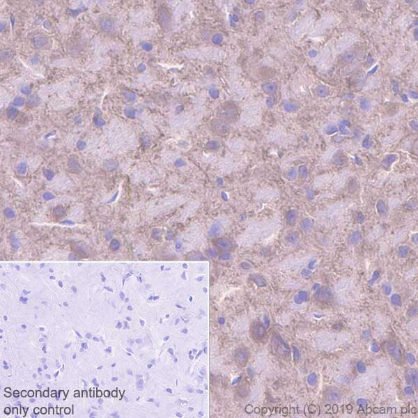 Immunohistochemistry (Formalin/PFA-fixed paraffin-embedded sections) - Anti-MAP2 antibody [EPR22641-16] (ab254264), expandable thumbnail