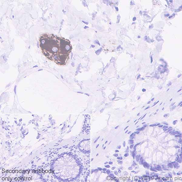Immunohistochemistry (Formalin/PFA-fixed paraffin-embedded sections) - Anti-MAP2 antibody [EPR22641-16] (ab254264), expandable thumbnail
