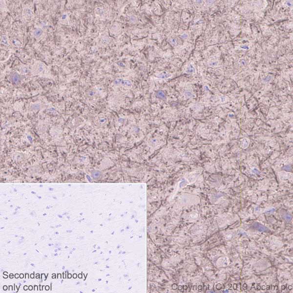 Immunohistochemistry (Formalin/PFA-fixed paraffin-embedded sections) - Anti-MAP2 antibody [EPR22641-16] (ab254264), expandable thumbnail