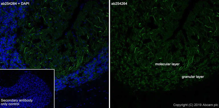 MAP2抗体[EPR22641-16] - Neuronal Marker (ab254264)| Abcam中文官网