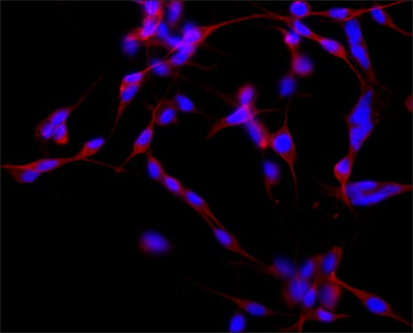 Immunocytochemistry - Anti-MAP2 antibody [HM-2] - Neuronal Marker (AB11267), expandable thumbnail