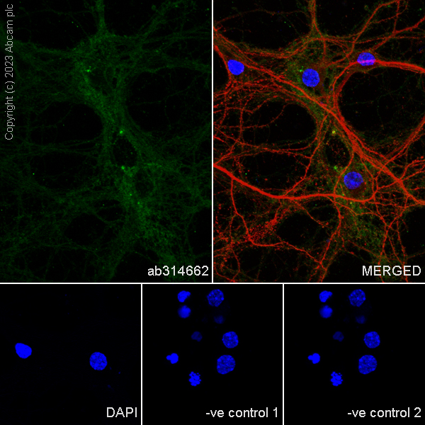 Immunocytochemistry/ Immunofluorescence - Anti-MAP2 antibody [HM-2] - Neuronal Marker (ab11267), expandable thumbnail