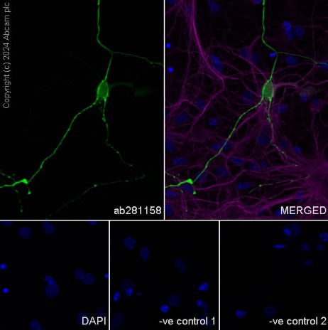 Immunocytochemistry/ Immunofluorescence - Anti-MAP2 antibody [HM-2] - Neuronal Marker (ab11267), expandable thumbnail