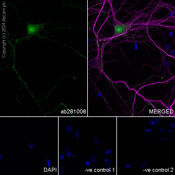 Immunocytochemistry/ Immunofluorescence - Anti-MAP2 antibody [HM-2] - Neuronal Marker (ab11267), expandable thumbnail