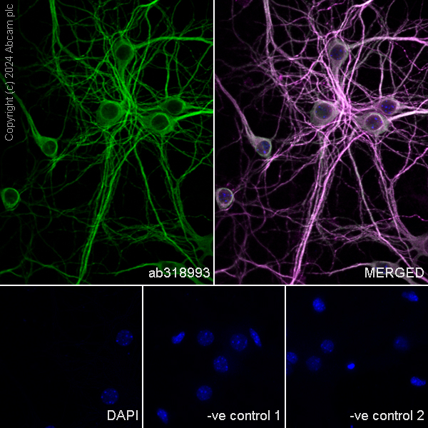 Immunocytochemistry/ Immunofluorescence - Anti-MAP2 antibody [HM-2] - Neuronal Marker (ab11267), expandable thumbnail