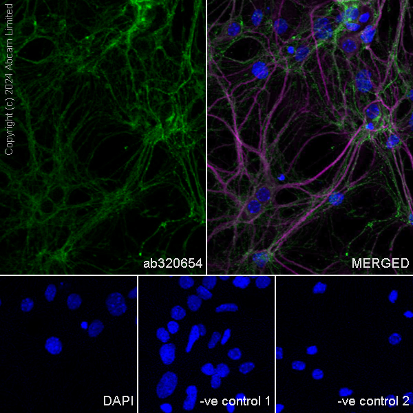Immunocytochemistry/ Immunofluorescence - Anti-MAP2 antibody [HM-2] - Neuronal Marker (ab11267), expandable thumbnail