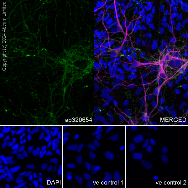 Immunocytochemistry/ Immunofluorescence - Anti-MAP2 antibody [HM-2] - Neuronal Marker (ab11267), expandable thumbnail