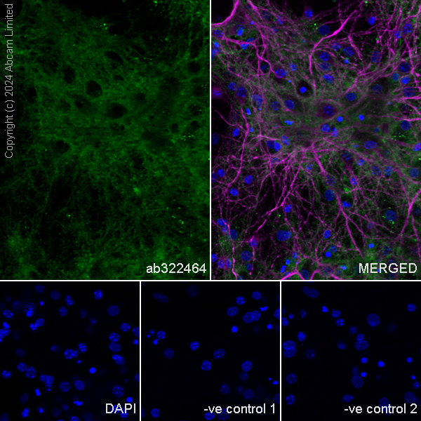 Immunocytochemistry/ Immunofluorescence - Anti-MAP2 antibody [HM-2] - Neuronal Marker (ab11267), expandable thumbnail