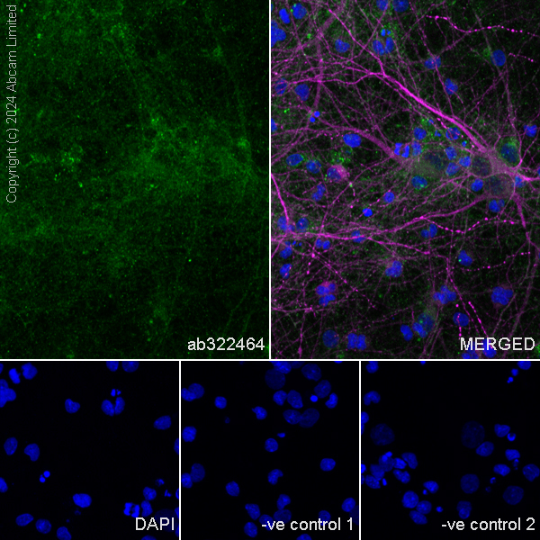 Immunocytochemistry/ Immunofluorescence - Anti-MAP2 antibody [HM-2] - Neuronal Marker (ab11267), expandable thumbnail
