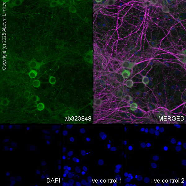 Immunocytochemistry/ Immunofluorescence - Anti-MAP2 antibody [HM-2] - Neuronal Marker (AB11267)
