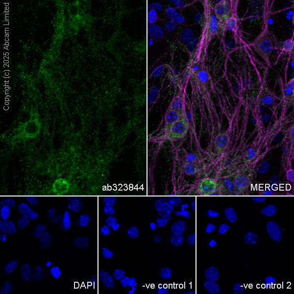 Immunocytochemistry/ Immunofluorescence - Anti-MAP2 antibody [HM-2] - Neuronal Marker (ab11267), expandable thumbnail
