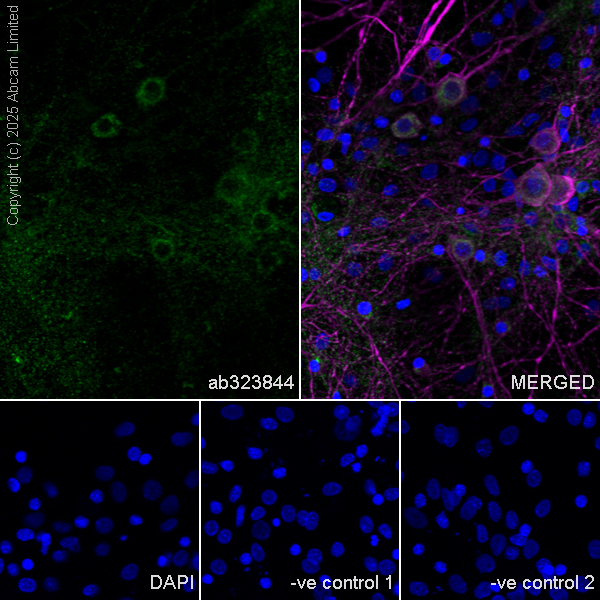 Immunocytochemistry/ Immunofluorescence - Anti-MAP2 antibody [HM-2] - Neuronal Marker (ab11267), expandable thumbnail