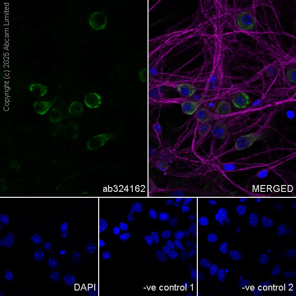 Immunocytochemistry/ Immunofluorescence - Anti-MAP2 antibody [HM-2] - Neuronal Marker (AB11267)