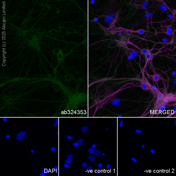 Anti-MAP2 antibody [HM-2] Neuronal Marker (ab11267) Abcam