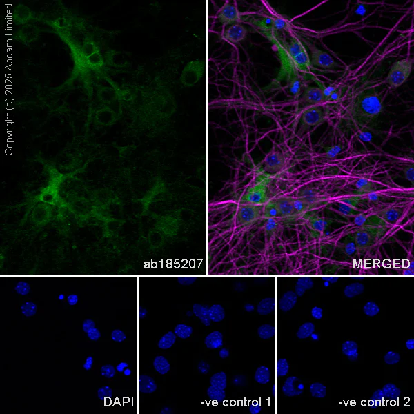 Immunocytochemistry/ Immunofluorescence - Anti-MAP2 antibody [HM-2] - Neuronal Marker (AB11267)