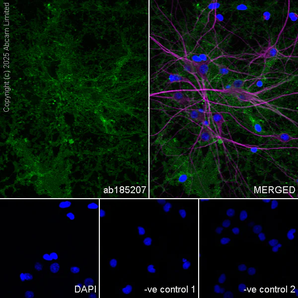 Immunocytochemistry/ Immunofluorescence - Anti-MAP2 antibody [HM-2] - Neuronal Marker (AB11267)