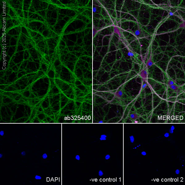 Immunocytochemistry/ Immunofluorescence - Anti-MAP2 antibody [HM-2] - Neuronal Marker (AB11267)