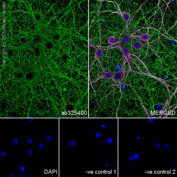 Immunocytochemistry/ Immunofluorescence - Anti-MAP2 antibody [HM-2] - Neuronal Marker (AB11267)