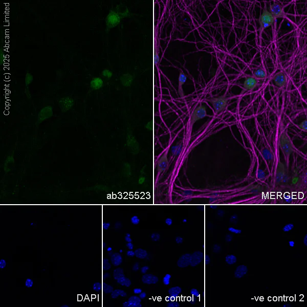 Immunocytochemistry/ Immunofluorescence - Anti-MAP2 antibody [HM-2] - Neuronal Marker (AB11267)
