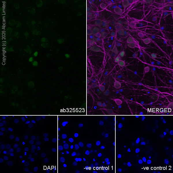 Immunocytochemistry/ Immunofluorescence - Anti-MAP2 antibody [HM-2] - Neuronal Marker (AB11267)