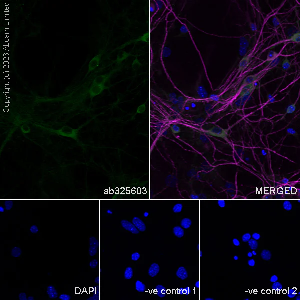 Immunocytochemistry/ Immunofluorescence - Anti-MAP2 antibody [HM-2] - Neuronal Marker (AB11267)