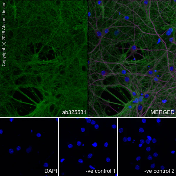Immunocytochemistry/ Immunofluorescence - Anti-MAP2 antibody [HM-2] - Neuronal Marker (AB11267)