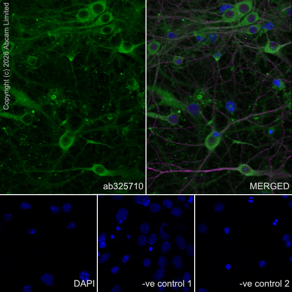 Immunocytochemistry/ Immunofluorescence - Anti-MAP2 antibody [HM-2] - Neuronal Marker (AB11267)