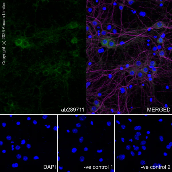 Immunocytochemistry/ Immunofluorescence - Anti-MAP2 antibody [HM-2] - Neuronal Marker (AB11267)