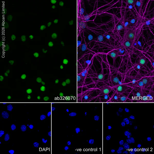 Immunocytochemistry/ Immunofluorescence - Anti-MAP2 antibody [HM-2] - Neuronal Marker (AB11267)