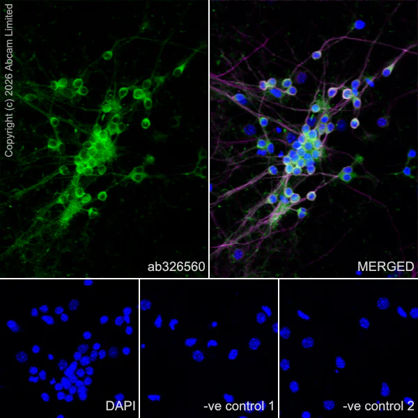 Immunocytochemistry/ Immunofluorescence - Anti-MAP2 antibody [HM-2] - Neuronal Marker (AB11267)