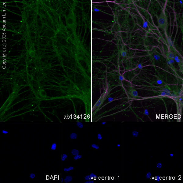 Immunocytochemistry/ Immunofluorescence - Anti-MAP2 antibody [HM-2] - Neuronal Marker (AB11267)