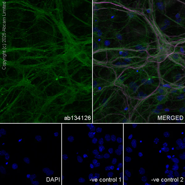 Immunocytochemistry/ Immunofluorescence - Anti-MAP2 antibody [HM-2] - Neuronal Marker (AB11267)