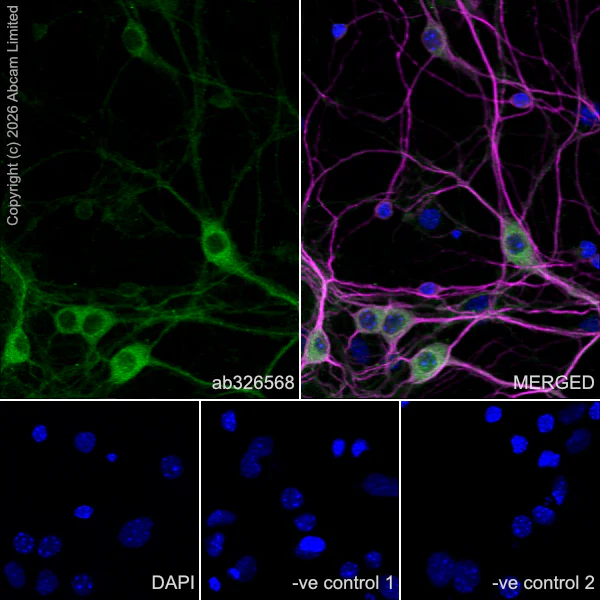 Immunocytochemistry/ Immunofluorescence - Anti-MAP2 antibody [HM-2] - Neuronal Marker (AB11267)