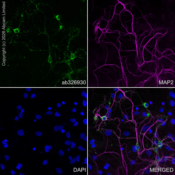 Immunocytochemistry/ Immunofluorescence - Anti-MAP2 antibody [HM-2] - Neuronal Marker (AB11267)