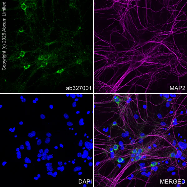 Immunocytochemistry/ Immunofluorescence - Anti-MAP2 antibody [HM-2] - Neuronal Marker (AB11267)