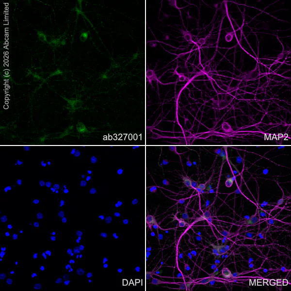 Immunocytochemistry/ Immunofluorescence - Anti-MAP2 antibody [HM-2] - Neuronal Marker (AB11267)