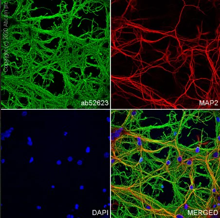 Immunocytochemistry/ Immunofluorescence - Anti-MAP2 antibody [HM-2] - Neuronal Marker (AB11267)